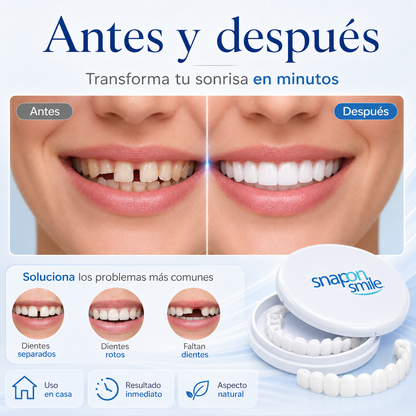 Carillas Dentales Removibles
