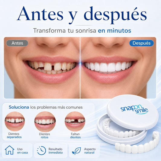 Carillas Dentales Removibles